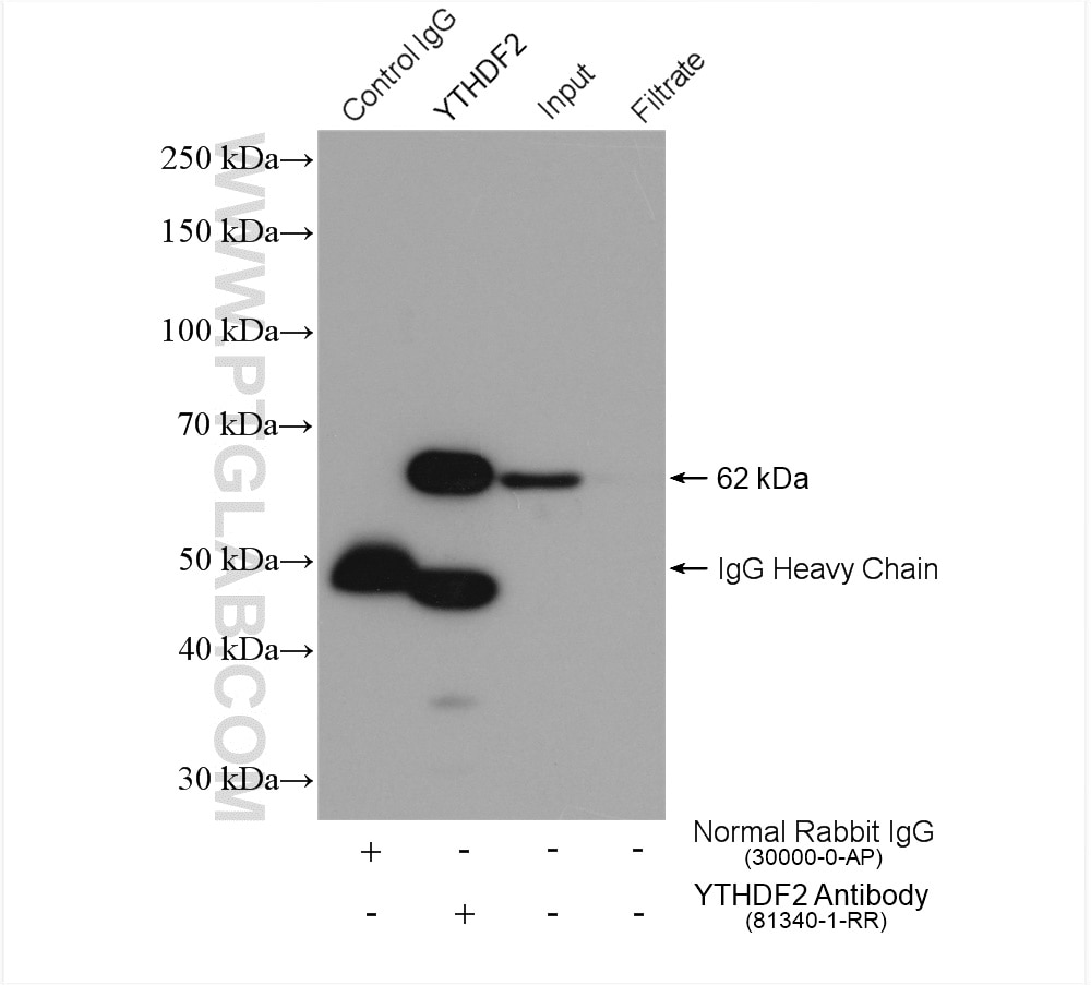 IP result of anti-YTHDF2 (IP:81340-1-RR, 4ug; Detection:81340-1-RR 1:1000) with HeLa cells lysate 1880 ug.