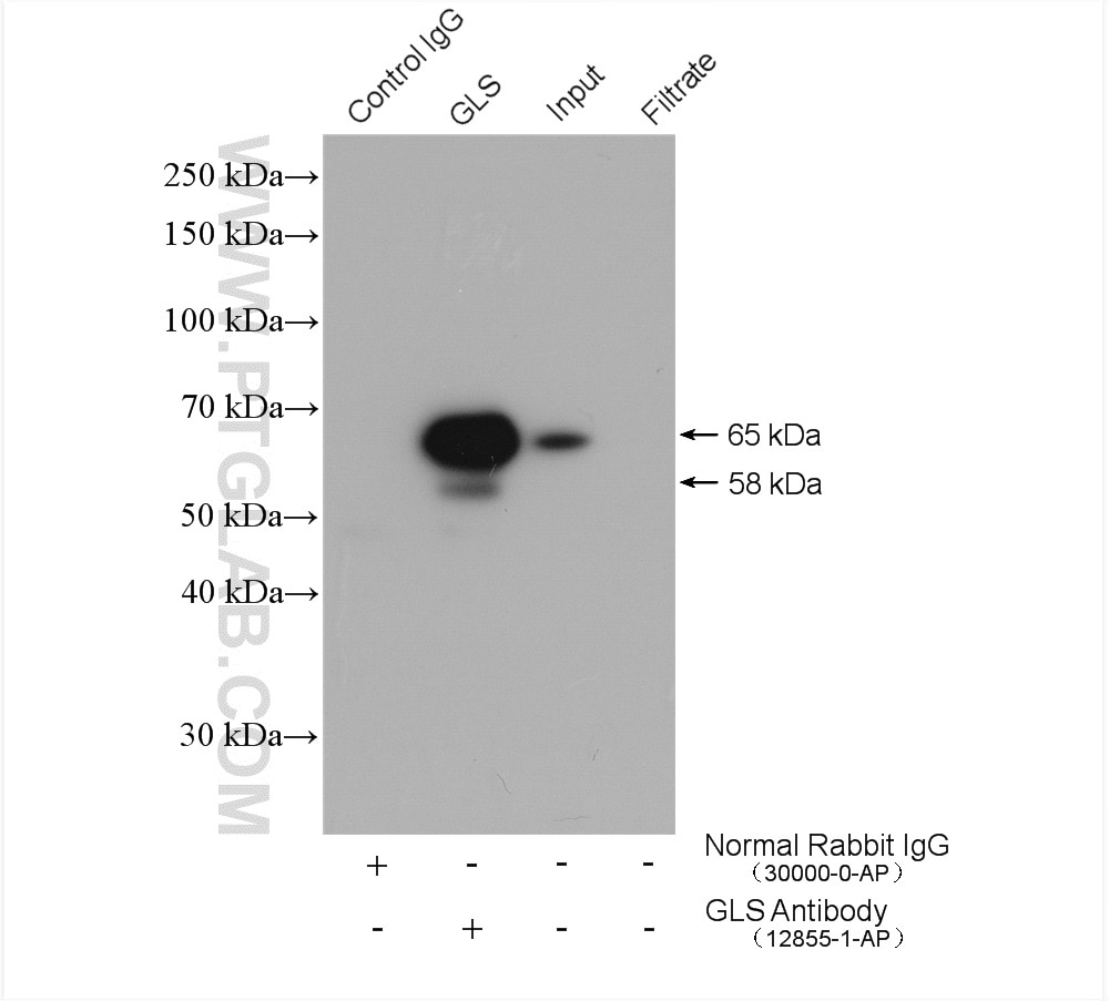 IP result of anti-KGA/GAC (IP:12855-1-AP, 4ug; Detection:12855-1-AP 1:5000) with mouse brain tissue lysate 2400 ug.