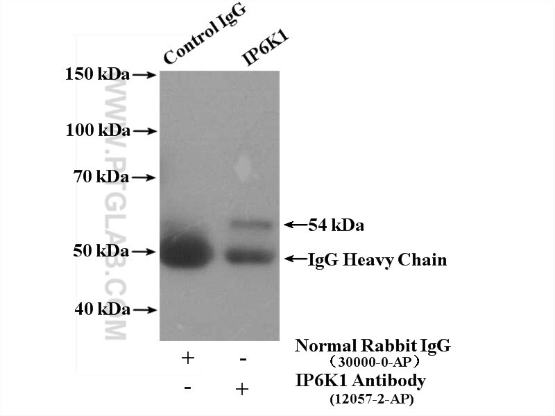 Immunoprecipitation (IP) experiment of mouse kidney tissue using IP6K1 Polyclonal antibody (12057-2-AP)