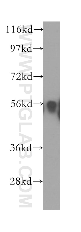 Western Blot (WB) analysis of human kidney tissue using IP6K1 Polyclonal antibody (12057-2-AP)