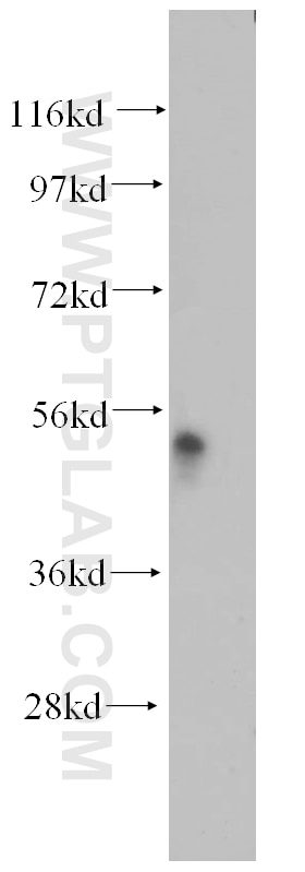 Western Blot (WB) analysis of human liver tissue using IP6K1 Polyclonal antibody (12057-2-AP)