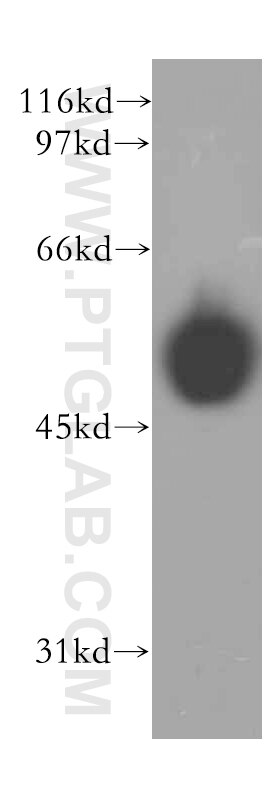 Western Blot (WB) analysis of human heart tissue using IP6K2 Polyclonal antibody (13155-1-AP)