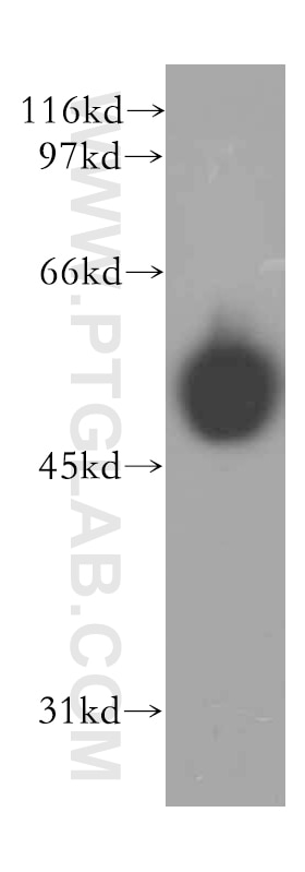 WB analysis of human heart using 13155-1-AP