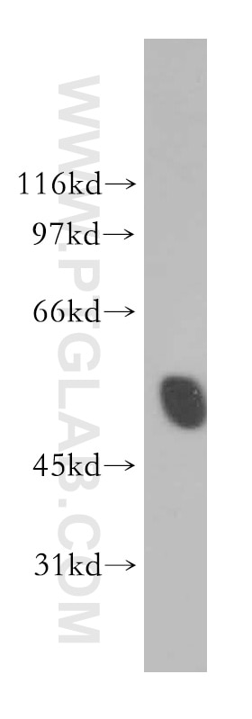 Western Blot (WB) analysis of K-562 cells using IP6K2 Polyclonal antibody (13155-1-AP)