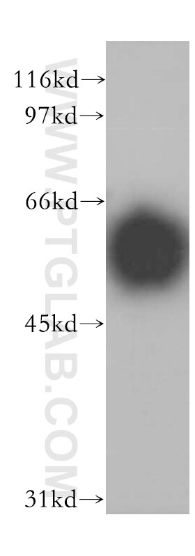 Western Blot (WB) analysis of human adrenal gland tissue using IP6K2 Polyclonal antibody (13155-1-AP)
