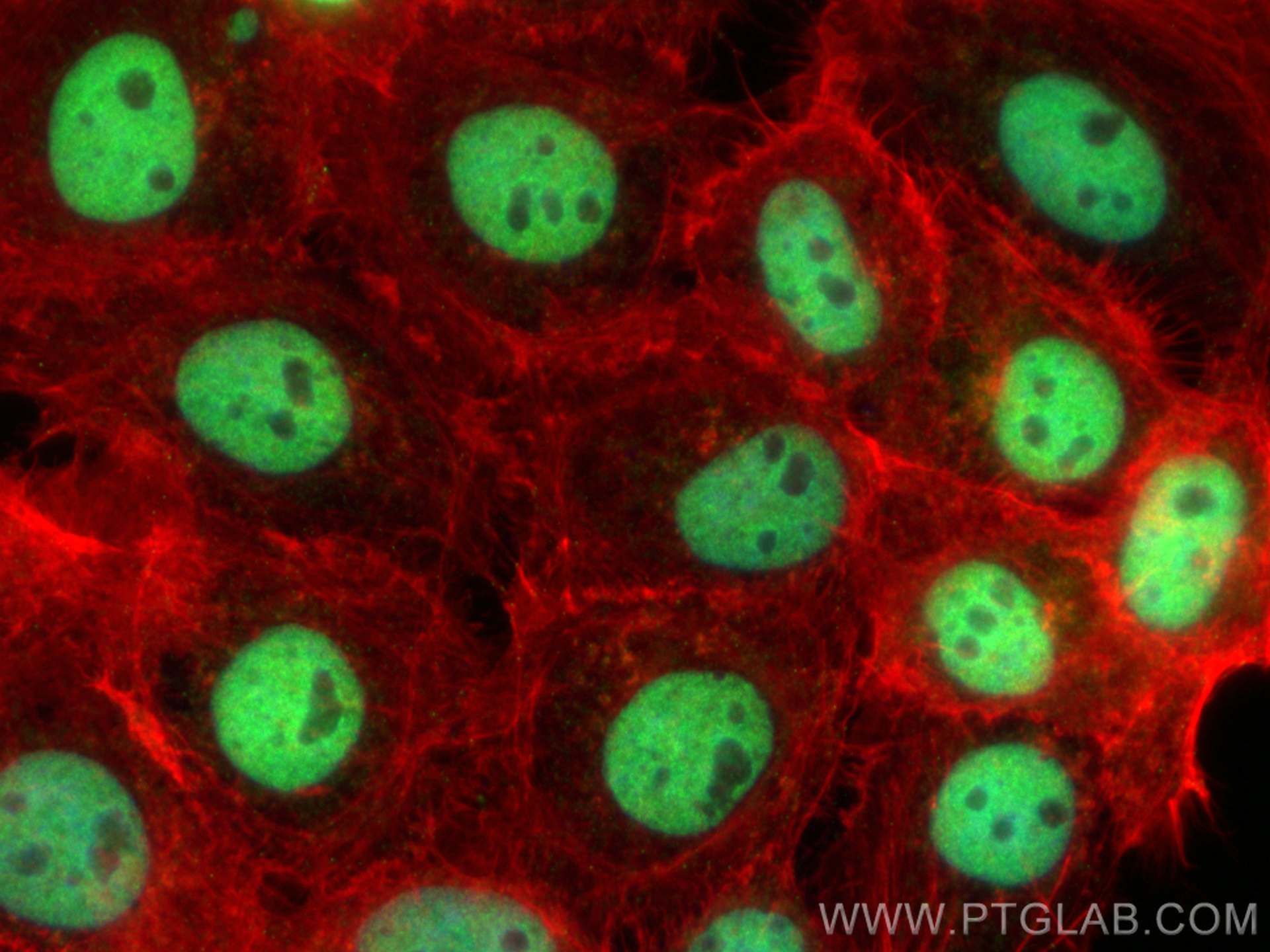 Immunofluorescence (IF) / fluorescent staining of A431 cells using IPMK Polyclonal antibody (30161-1-AP)