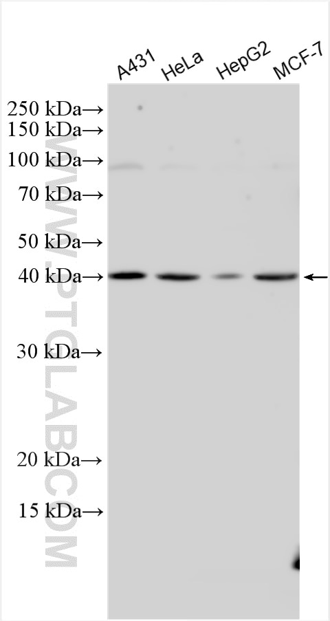 Western Blot (WB) analysis of various lysates using IPMK Polyclonal antibody (30161-1-AP)