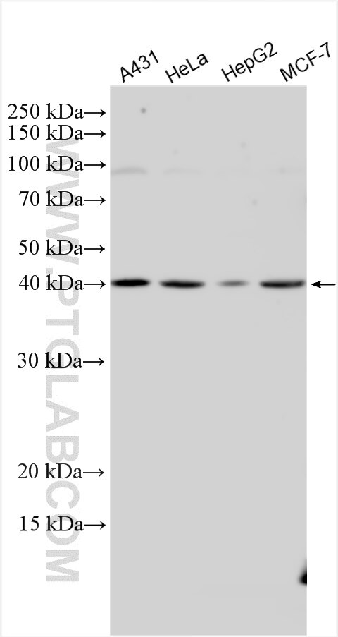 Western Blot (WB) analysis of various lysates using IPMK Polyclonal antibody (30161-1-AP)