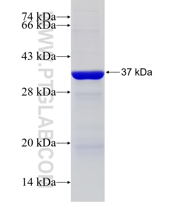 IPMK fusion protein Ag32377 SDS-PAGE