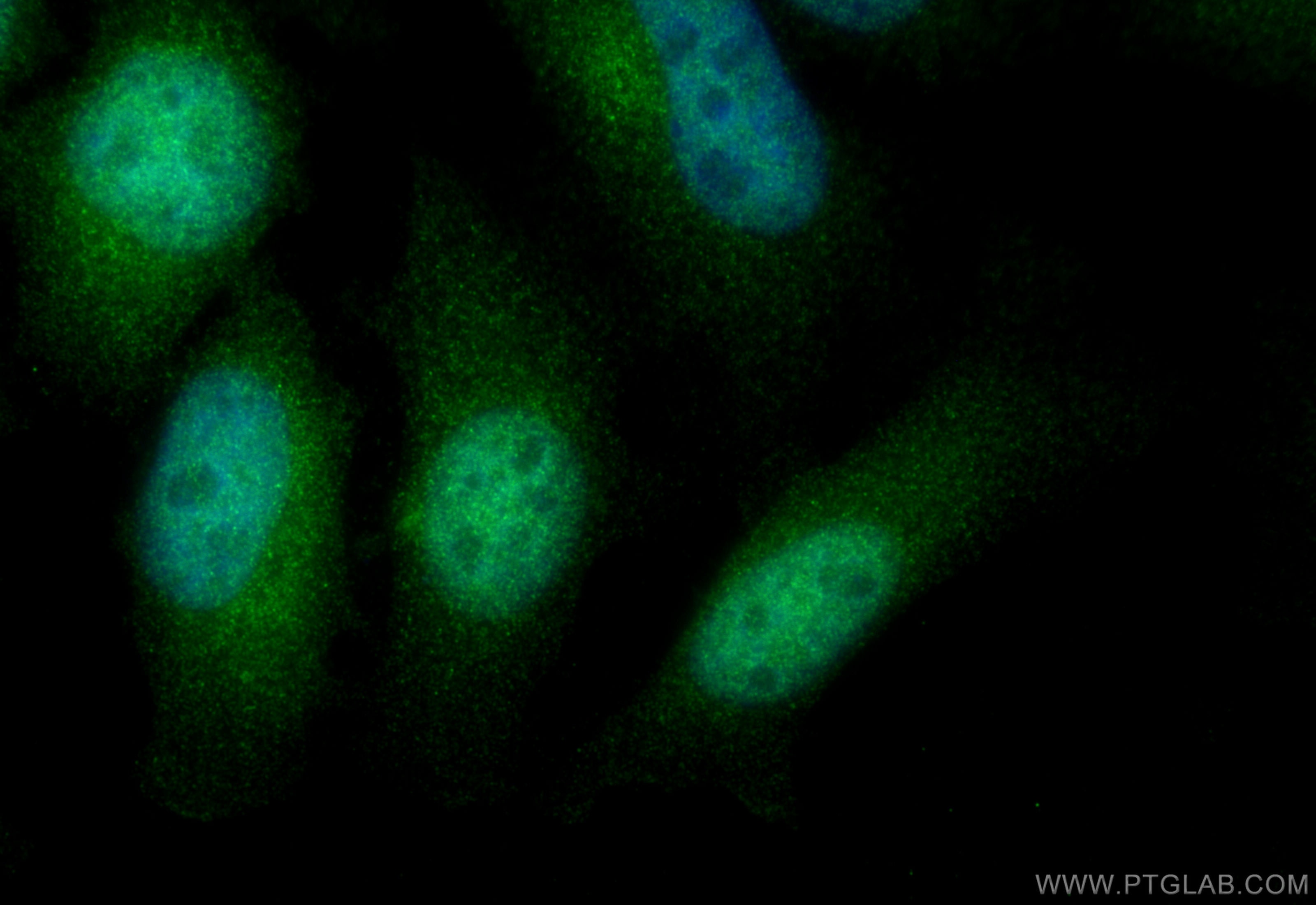 Immunofluorescence (IF) / fluorescent staining of HeLa cells using IPO11 Polyclonal antibody (14403-1-AP)
