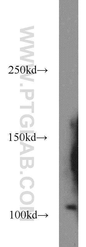 Western Blot (WB) analysis of human testis tissue using IPO11 Polyclonal antibody (14403-1-AP)