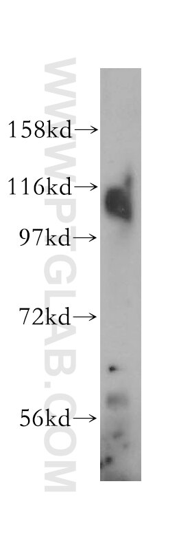 Western Blot (WB) analysis of human testis tissue using IPO11 Polyclonal antibody (14403-1-AP)