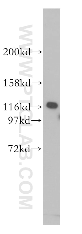 Western Blot (WB) analysis of human brain tissue using IPO4 Polyclonal antibody (11679-1-AP)