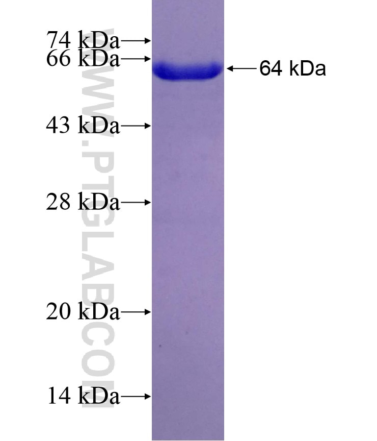 IPO4 fusion protein Ag2281 SDS-PAGE