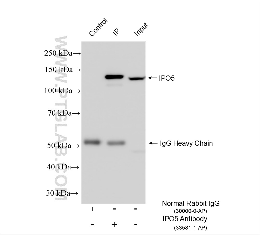 Immunoprecipitation (IP) experiment of HeLa cells using IPO5 Polyclonal antibody (33581-1-AP)