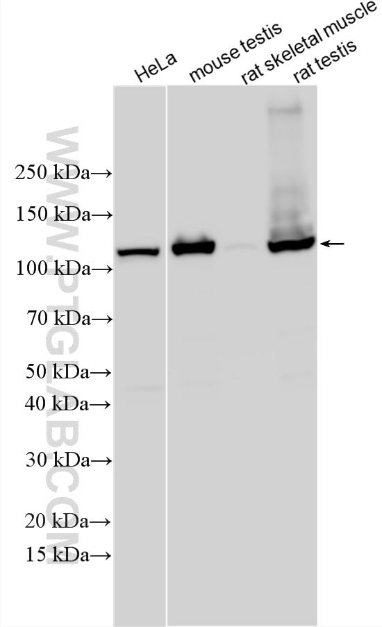 Western Blot (WB) analysis of various lysates using IPO5 Polyclonal antibody (33581-1-AP)