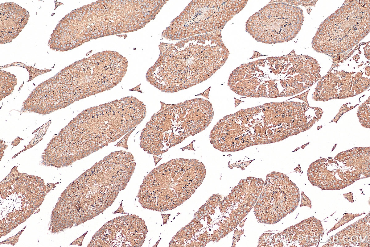 IHC staining of mouse testis using 67962-1-Ig