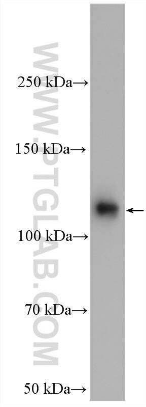 Western Blot (WB) analysis of HeLa cells using IPO7 Polyclonal antibody (28289-1-AP)