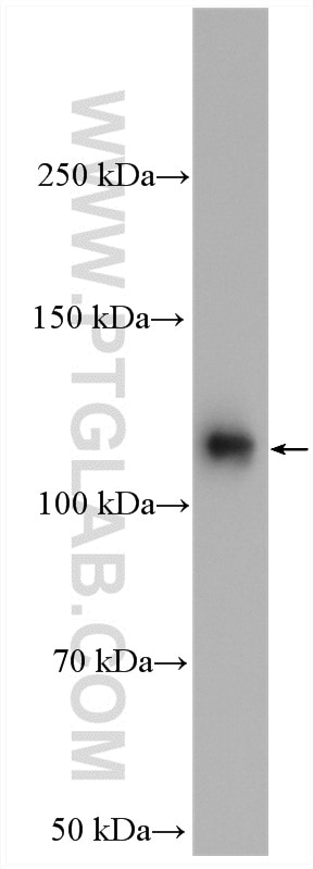 Western Blot (WB) analysis of HeLa cells using IPO7 Polyclonal antibody (28289-1-AP)