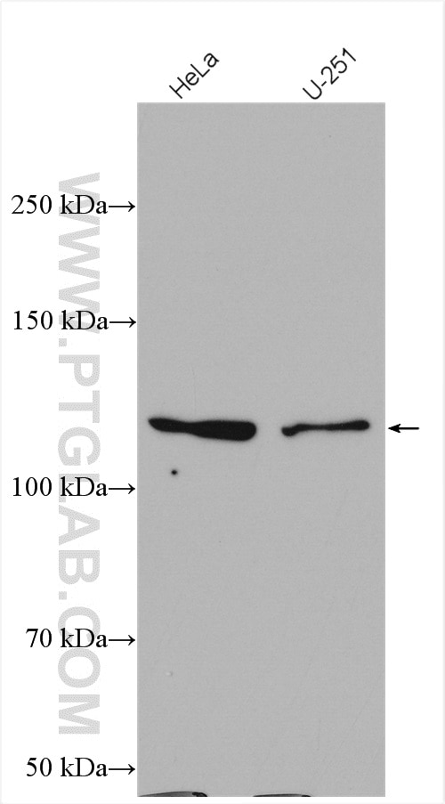 Western Blot (WB) analysis of various lysates using IPO7 Polyclonal antibody (28289-1-AP)