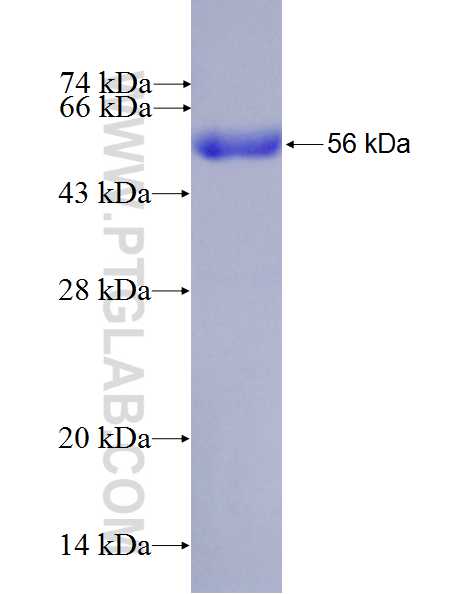 IPO7 fusion protein Ag27257 SDS-PAGE