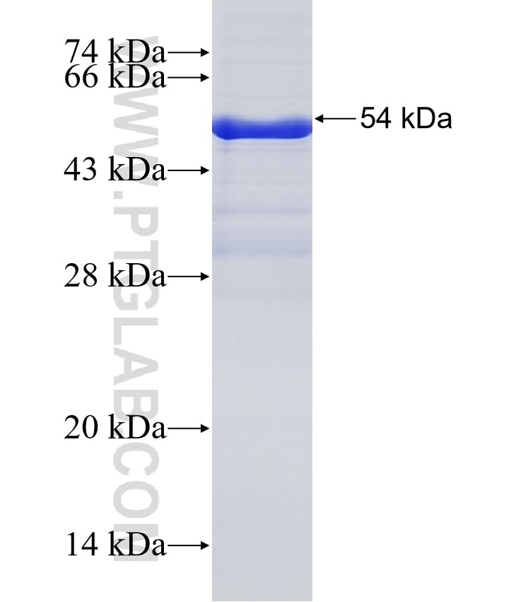 IPO8 fusion protein Ag35395 SDS-PAGE