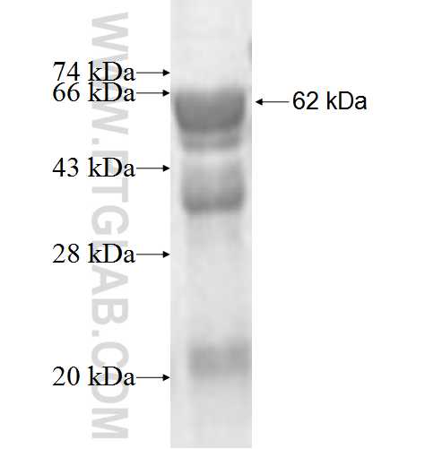 IPP fusion protein Ag4569 SDS-PAGE