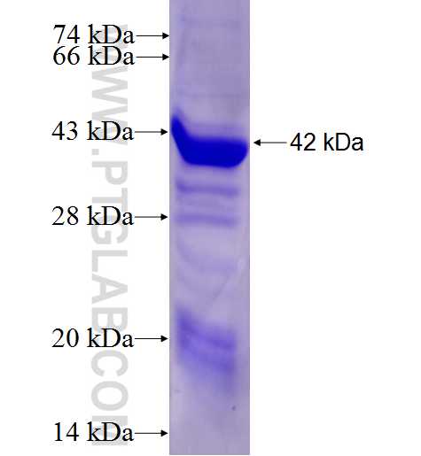 IPP fusion protein Ag5539 SDS-PAGE IPP fusion protein Ag5539 SDS-PAGE