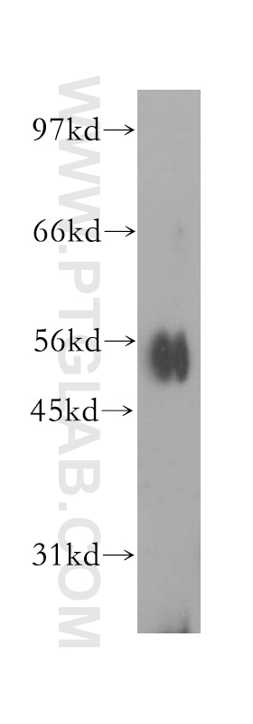 Western Blot (WB) analysis of Jurkat cells using IPPK Polyclonal antibody (12603-1-AP)