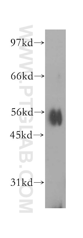 Western Blot (WB) analysis of Jurkat cells using IPPK Polyclonal antibody (12603-1-AP)