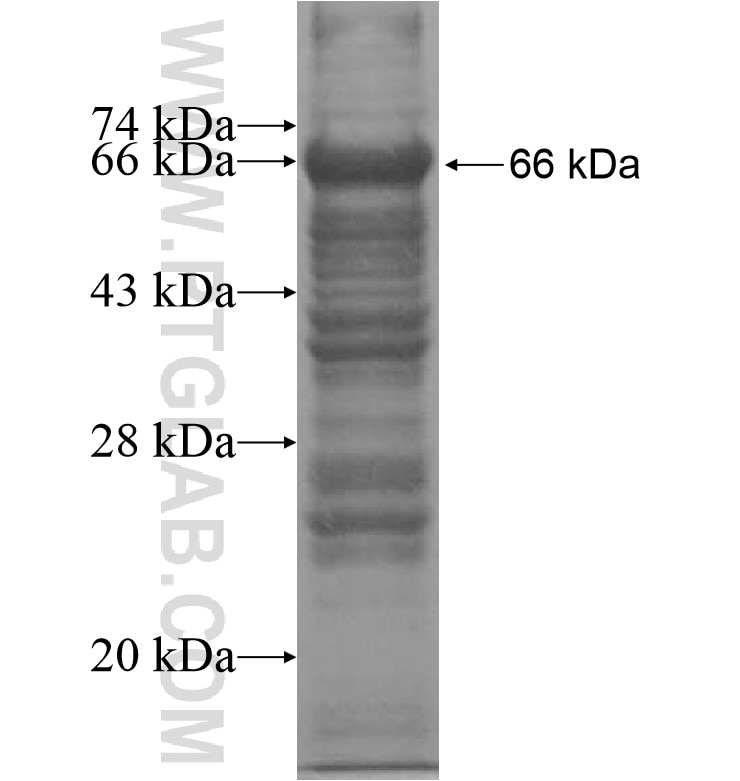 IQCC fusion protein Ag16161 SDS-PAGE