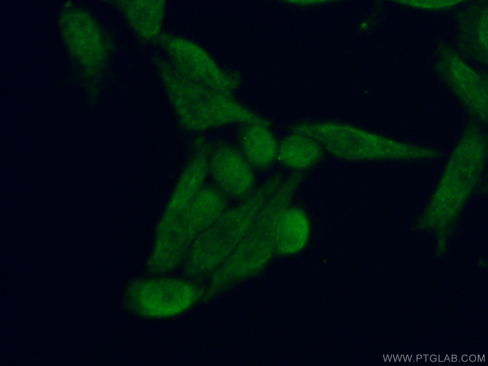 Immunofluorescence (IF) / fluorescent staining of HeLa cells using IQCD Polyclonal antibody (26345-1-AP)