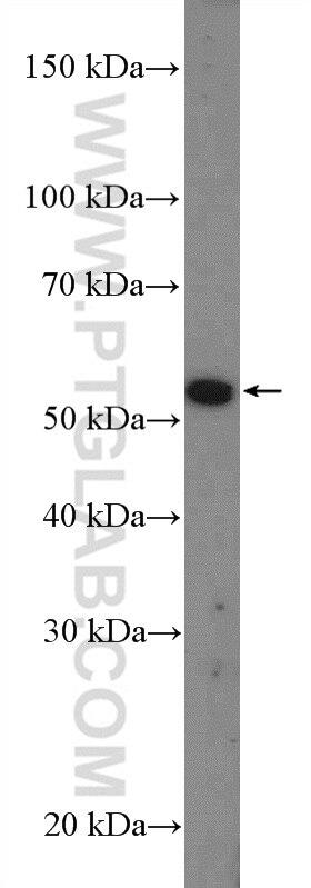 Western Blot (WB) analysis of mouse testis tissue using IQCD Polyclonal antibody (26345-1-AP)