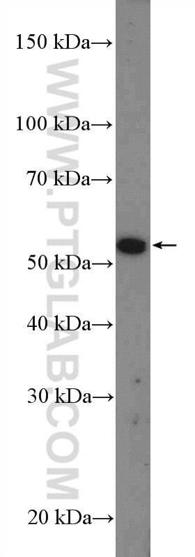 WB analysis of mouse testis using 26345-1-AP