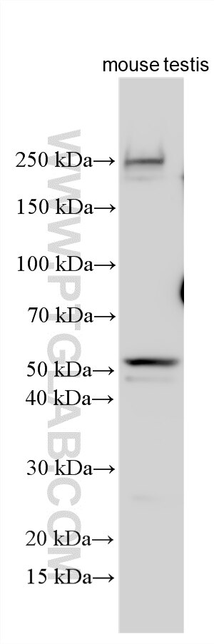 WB analysis using 33459-1-AP Western Blot (WB) analysis of various lysates using IQCG Polyclonal antibody (33459-1-AP)