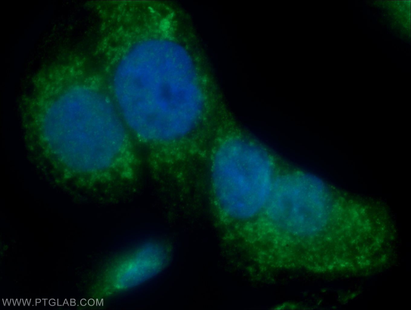 Immunofluorescence (IF) / fluorescent staining of COLO 320 cells using IQCK Polyclonal antibody (25740-1-AP)