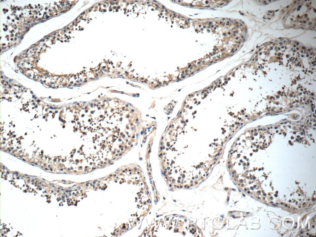 IHC staining of human testis using 25740-1-AP