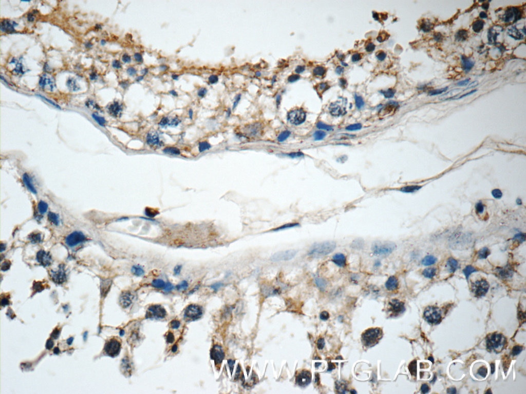 Immunohistochemistry (IHC) staining of human testis tissue using IQCK Polyclonal antibody (25740-1-AP)