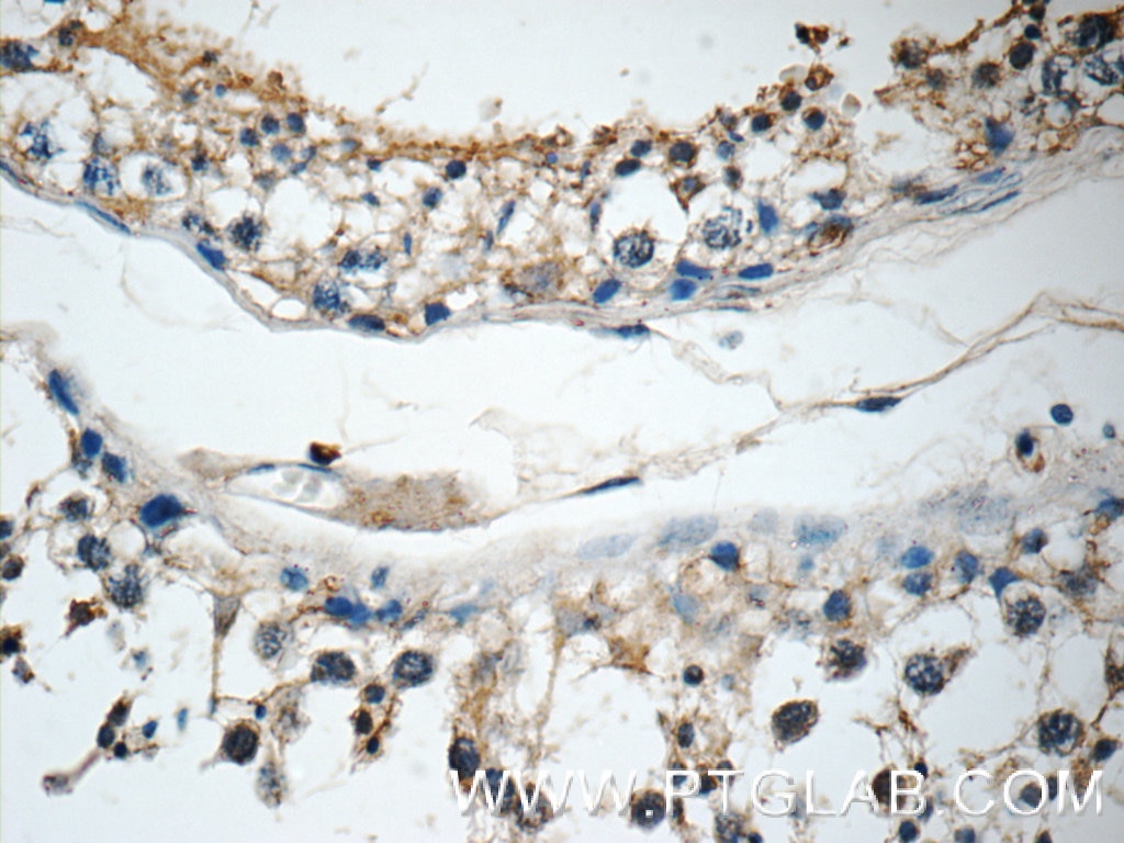 IHC staining of human testis using 25740-1-AP