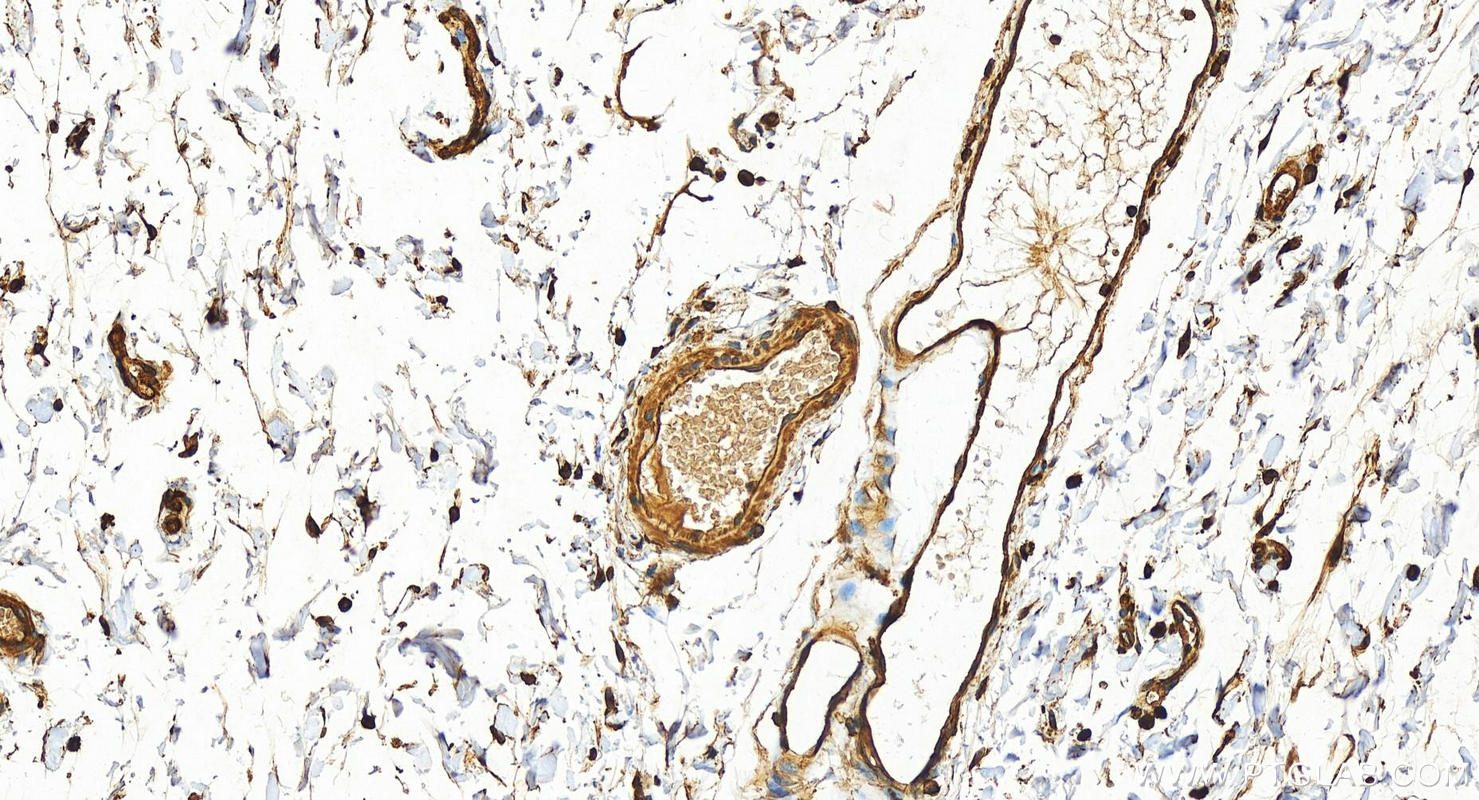 Immunohistochemical analysis of paraffin-embedded human normal colon slide using 22167-1-AP (IQGAP1 antibody) at dilution of 1:1000 (under 20x lens). Heat mediated antigen retrieval with Tris-EDTA buffer (pH 9.0). Immunohistochemistry (IHC) staining of human colon tissue using IQGAP1 Polyclonal antibody (22167-1-AP)