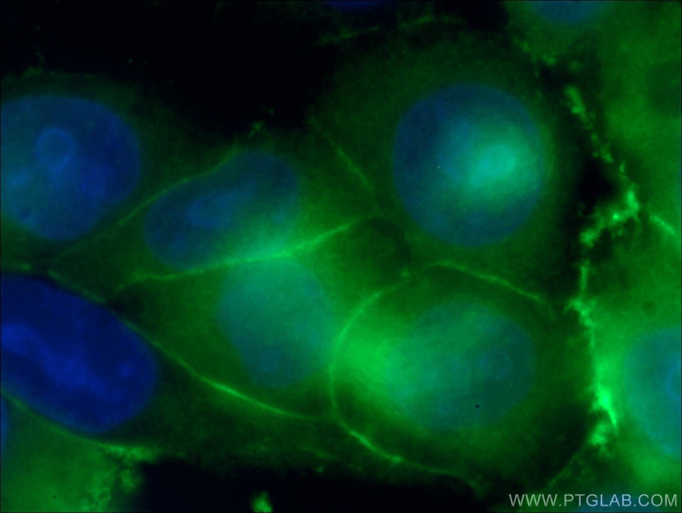 Immunofluorescence (IF) / fluorescent staining of HeLa cells using IQGAP1 Polyclonal antibody (22167-1-AP)