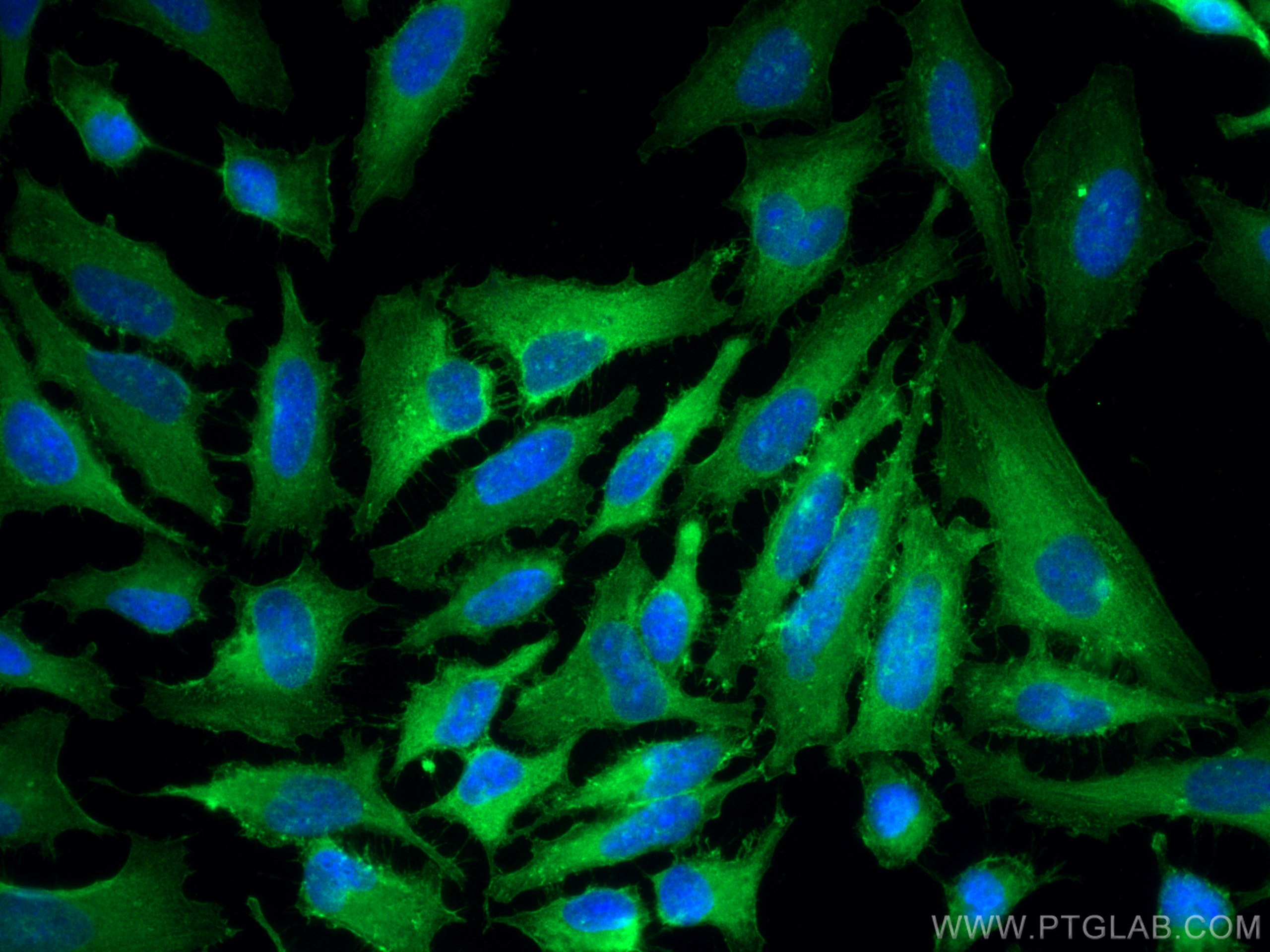 Immunofluorescence (IF) / fluorescent staining of HeLa cells using IQGAP1 Polyclonal antibody (22167-1-PBS)
