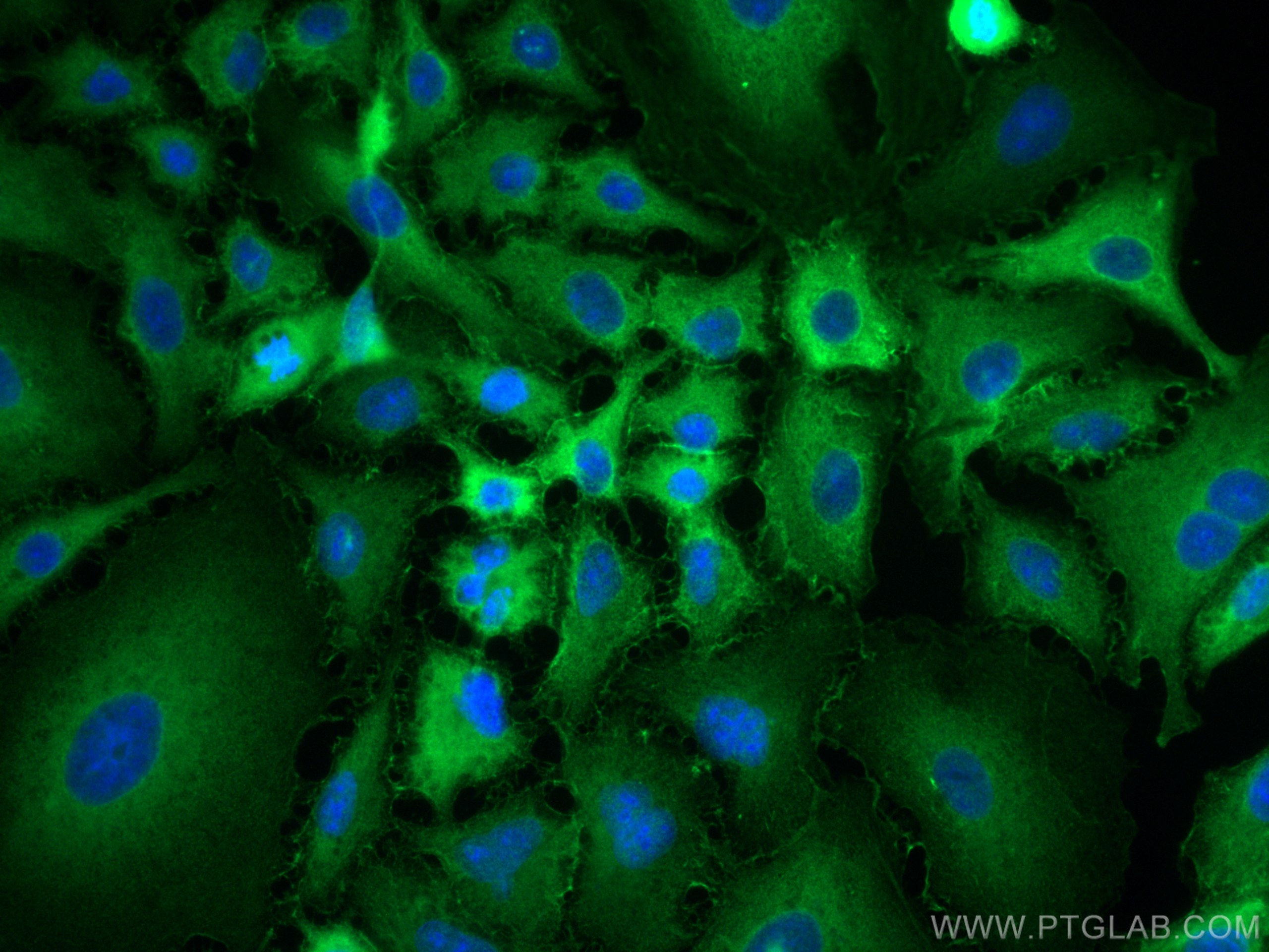 Immunofluorescence (IF) / fluorescent staining of A549 cells using IQGAP1 Polyclonal antibody (22167-1-PBS)