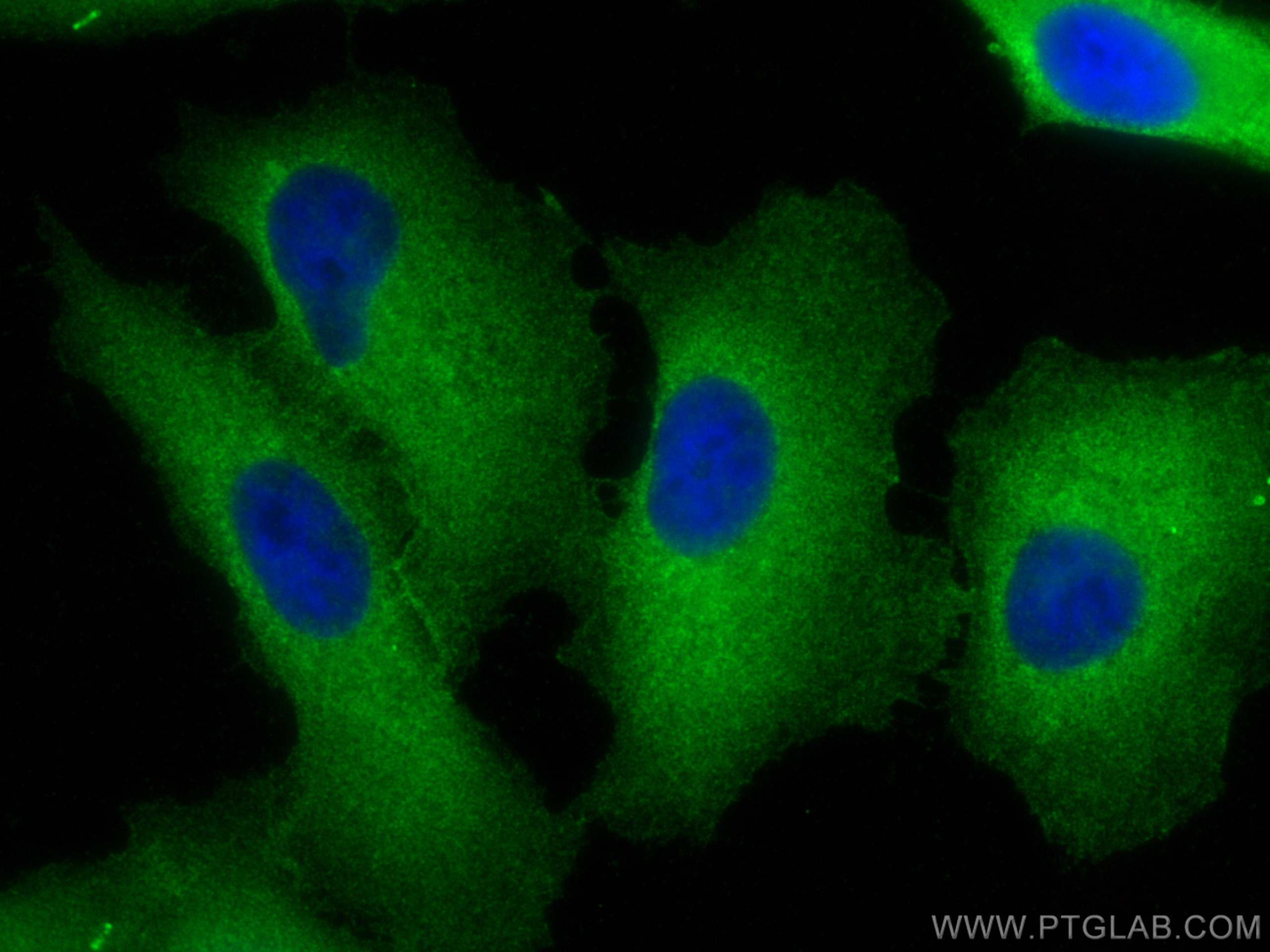 Immunofluorescence (IF) / fluorescent staining of A549 cells using IQGAP1 Polyclonal antibody (22167-1-AP)