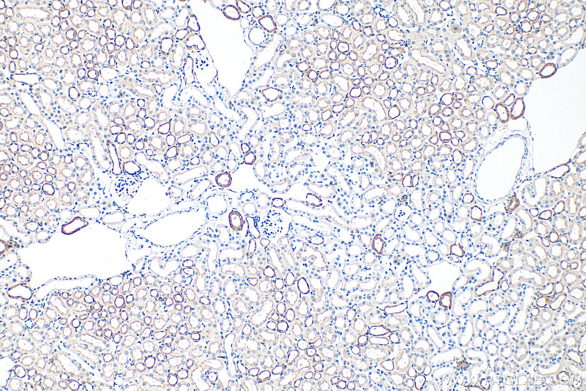 Immunohistochemical analysis of paraffin-embedded mouse kidney tissue slide using 22167-1-AP (IQGAP1 antibody) at dilution of 1:1000 (under 10x lens). Heat mediated antigen retrieval with Tris-EDTA buffer (pH 9.0). Immunohistochemistry (IHC) staining of mouse kidney tissue using IQGAP1 Polyclonal antibody (22167-1-AP)