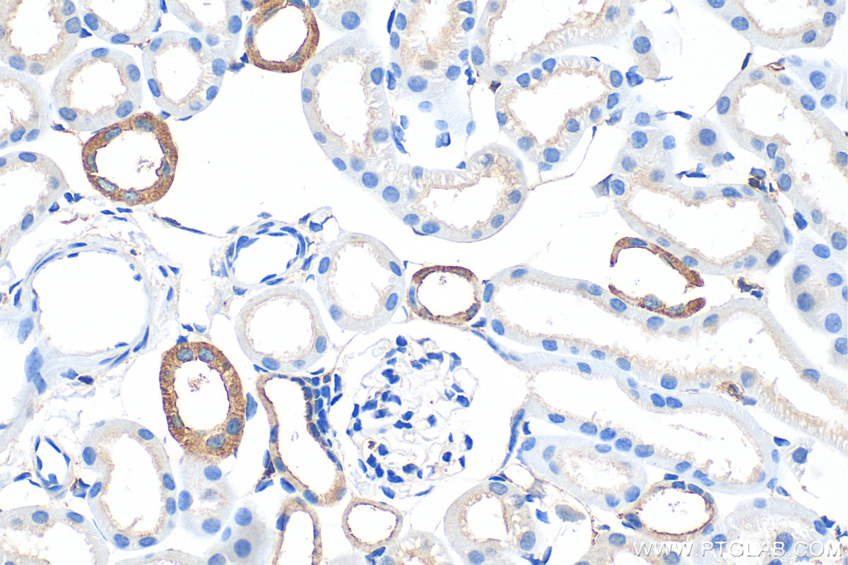 Immunohistochemical analysis of paraffin-embedded mouse kidney tissue slide using 22167-1-AP (IQGAP1 antibody) at dilution of 1:1000 (under 40x lens). Heat mediated antigen retrieval with Tris-EDTA buffer (pH 9.0). Immunohistochemistry (IHC) staining of mouse kidney tissue using IQGAP1 Polyclonal antibody (22167-1-AP)
