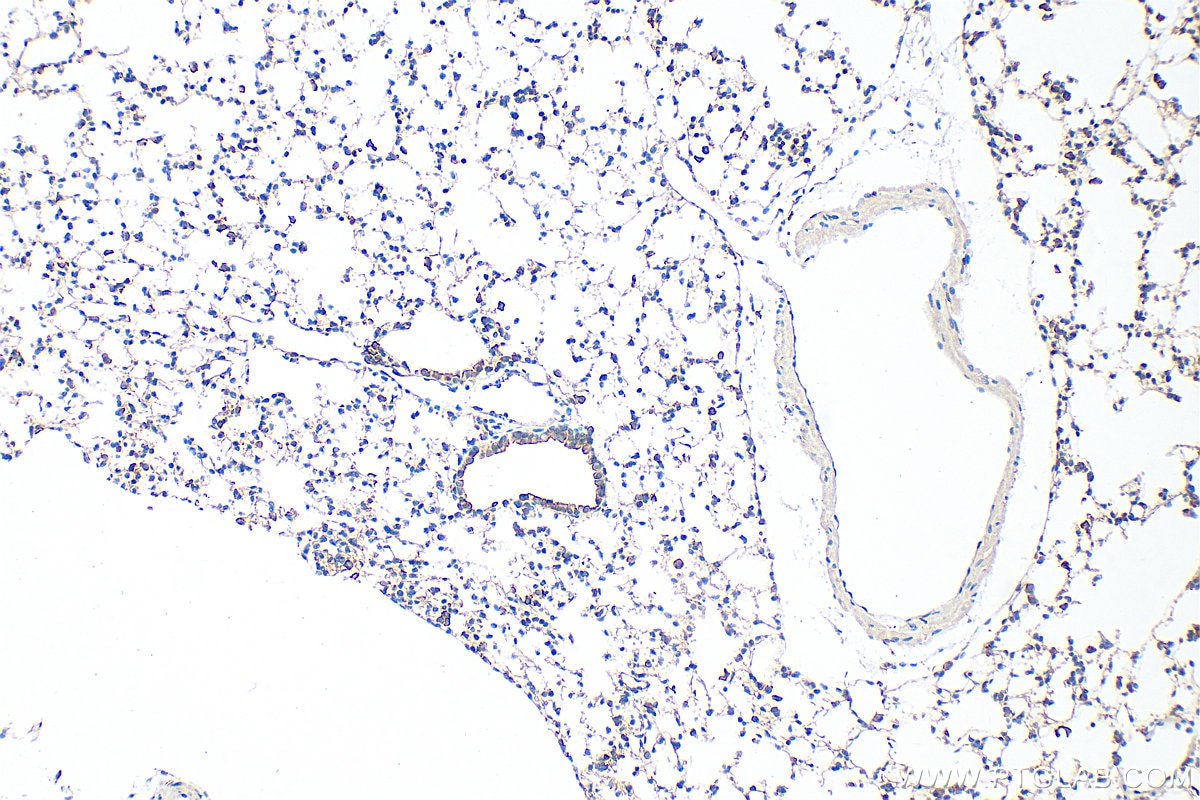 Immunohistochemical analysis of paraffin-embedded mouse lung tissue slide using 22167-1-AP (IQGAP1 antibody) at dilution of 1:1000 (under 10x lens). Heat mediated antigen retrieval with Tris-EDTA buffer (pH 9.0). Immunohistochemistry (IHC) staining of mouse lung tissue using IQGAP1 Polyclonal antibody (22167-1-AP)