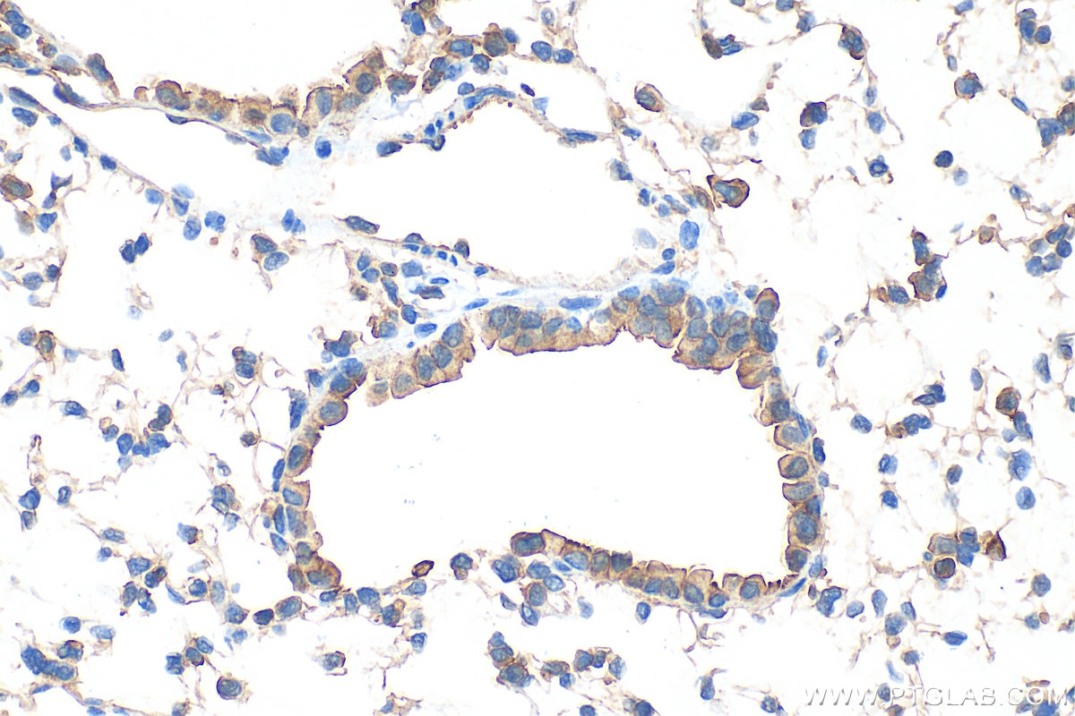 Immunohistochemical analysis of paraffin-embedded mouse lung tissue slide using 22167-1-AP (IQGAP1 antibody) at dilution of 1:1000 (under 40x lens). Heat mediated antigen retrieval with Tris-EDTA buffer (pH 9.0). Immunohistochemistry (IHC) staining of mouse lung tissue using IQGAP1 Polyclonal antibody (22167-1-AP)