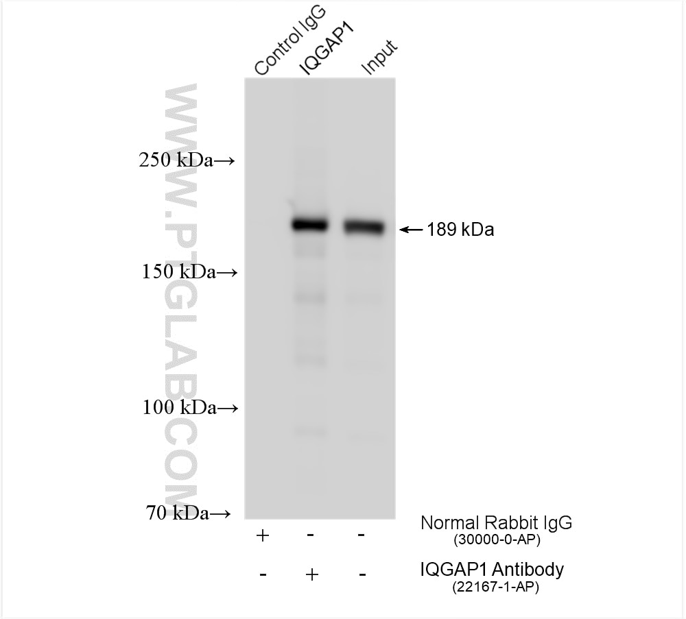 Immunoprecipitation (IP) experiment of HeLa cells using IQGAP1 Polyclonal antibody (22167-1-AP)