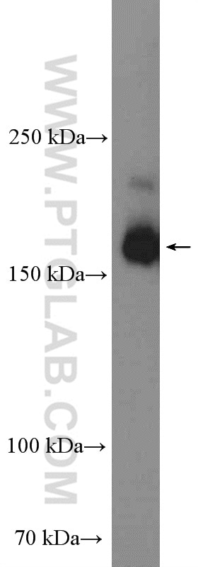 Western Blot (WB) analysis of HEK-293 cells using IQGAP1 Polyclonal antibody (22167-1-AP)